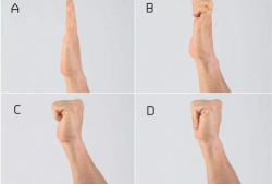 手腕康复训练视频教程,轻松掌握恢复技巧